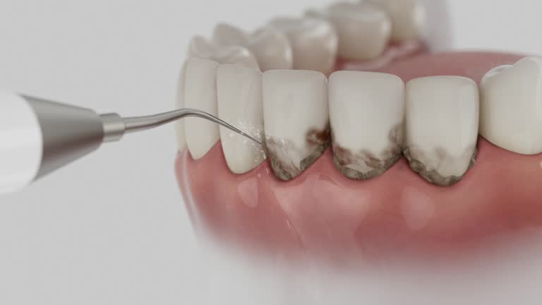 Reliable Root Canal Treatment contractor in Grant County County, WV by Dentist Open Now